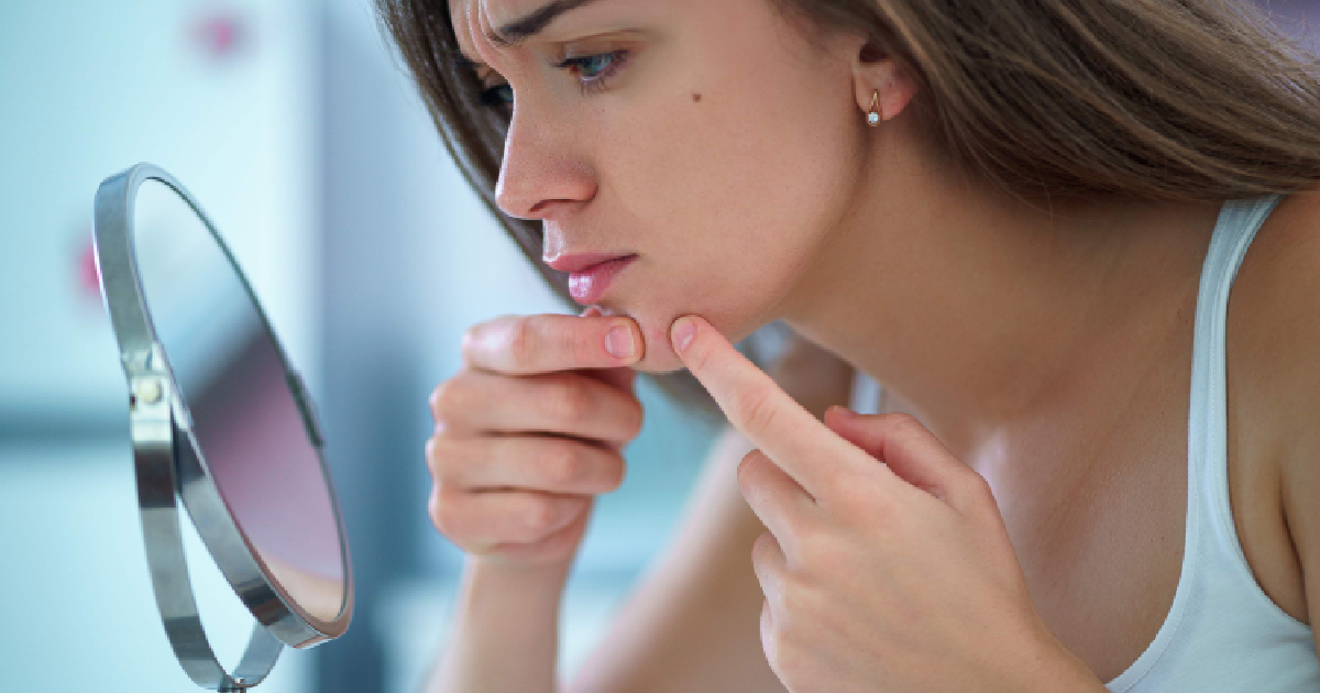 Woman examining seasonal acne on her chin in mirror with a concerned look in Tucson, AZ